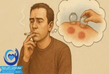 بعد از حجامت سیگار بکشیم چی می‌شود؟ راهنمای کامل